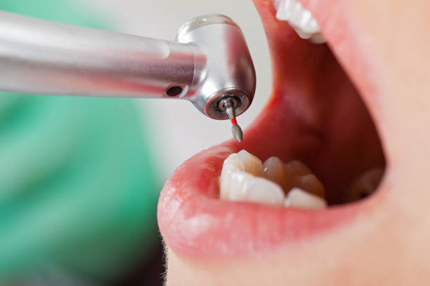 Best Emergency Dental Services for Seniors in Syracuse, IN